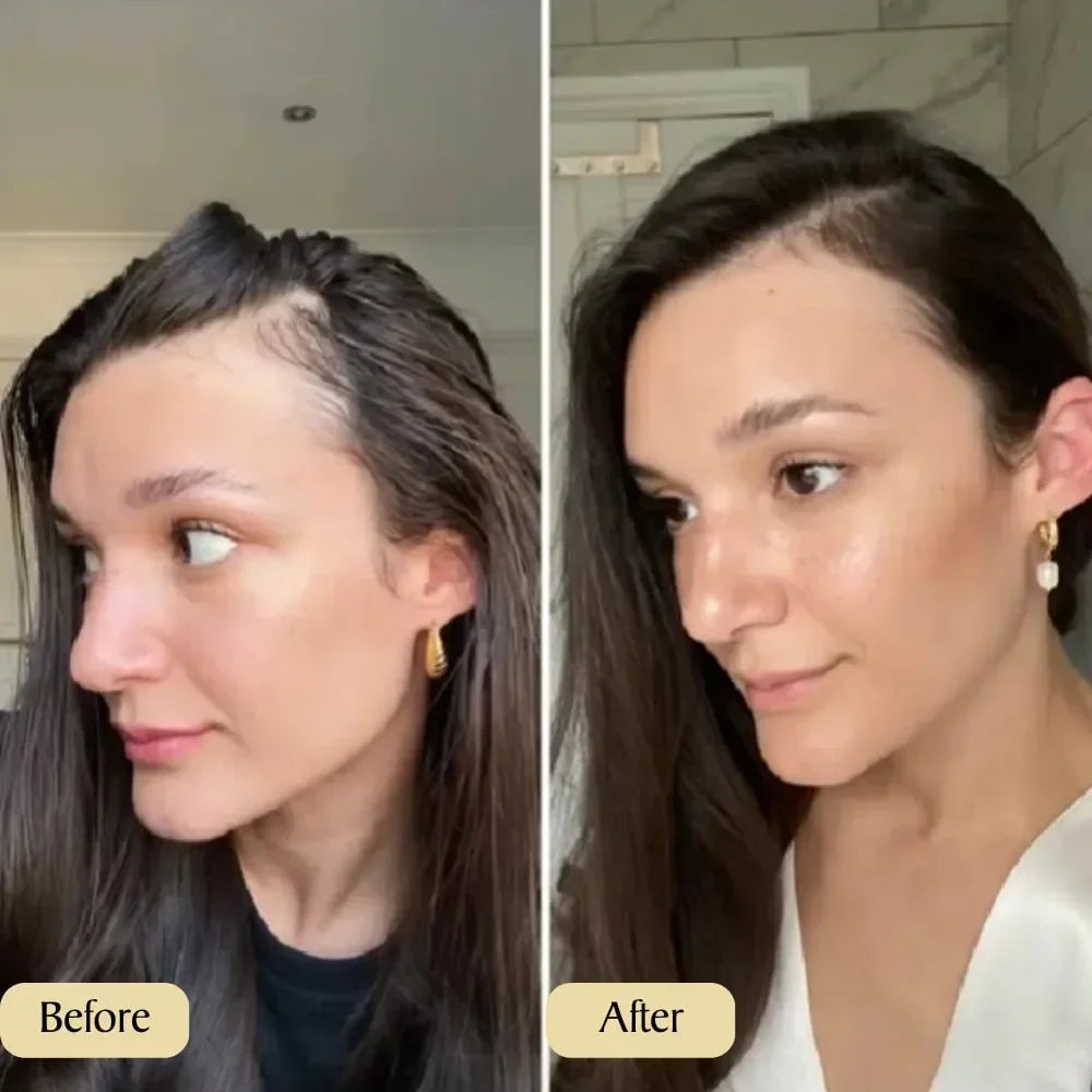 Carvenhy™ — Dichtes Haar in 30 Tagen | 50% Rabatt