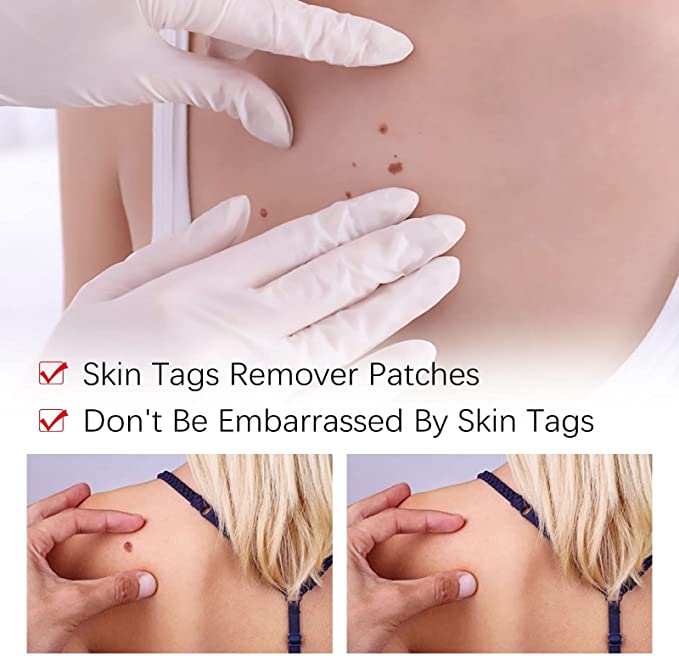 DermaBlitz™ — Endlich makellose Haut, die dein Selbstbewusstsein sofort stärkt