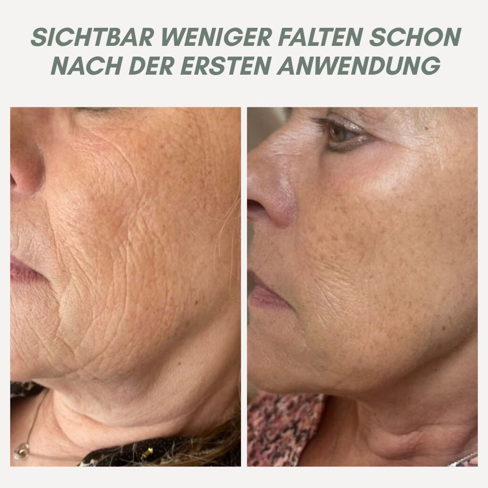 YouthMorph™ — Straffe Haut in Minuten für deinen jugendlichen WOW-Moment