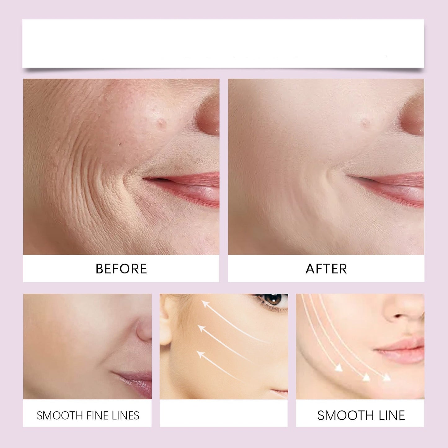 LuxLift™ — Heb dein Kinn, strahle Jugendlichkeit aus ohne OP!