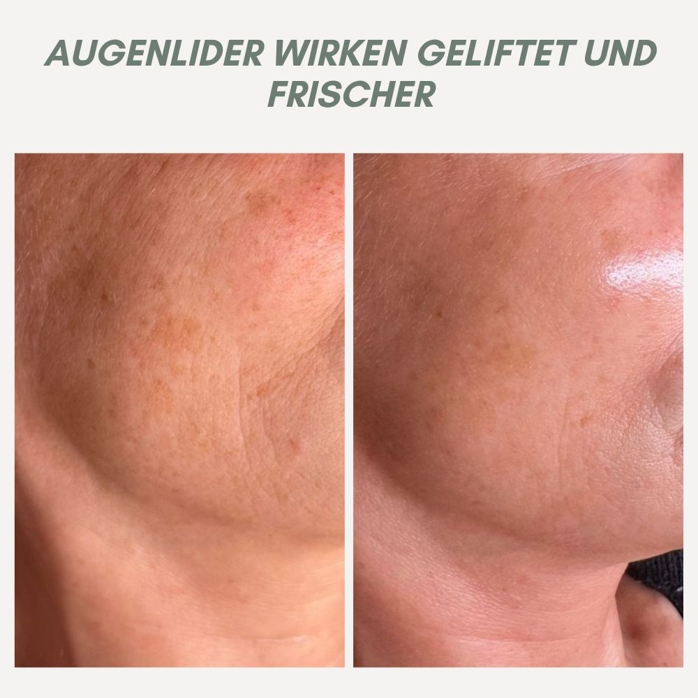 YouthMorph™ — Straffe Haut in Minuten für deinen jugendlichen WOW-Moment