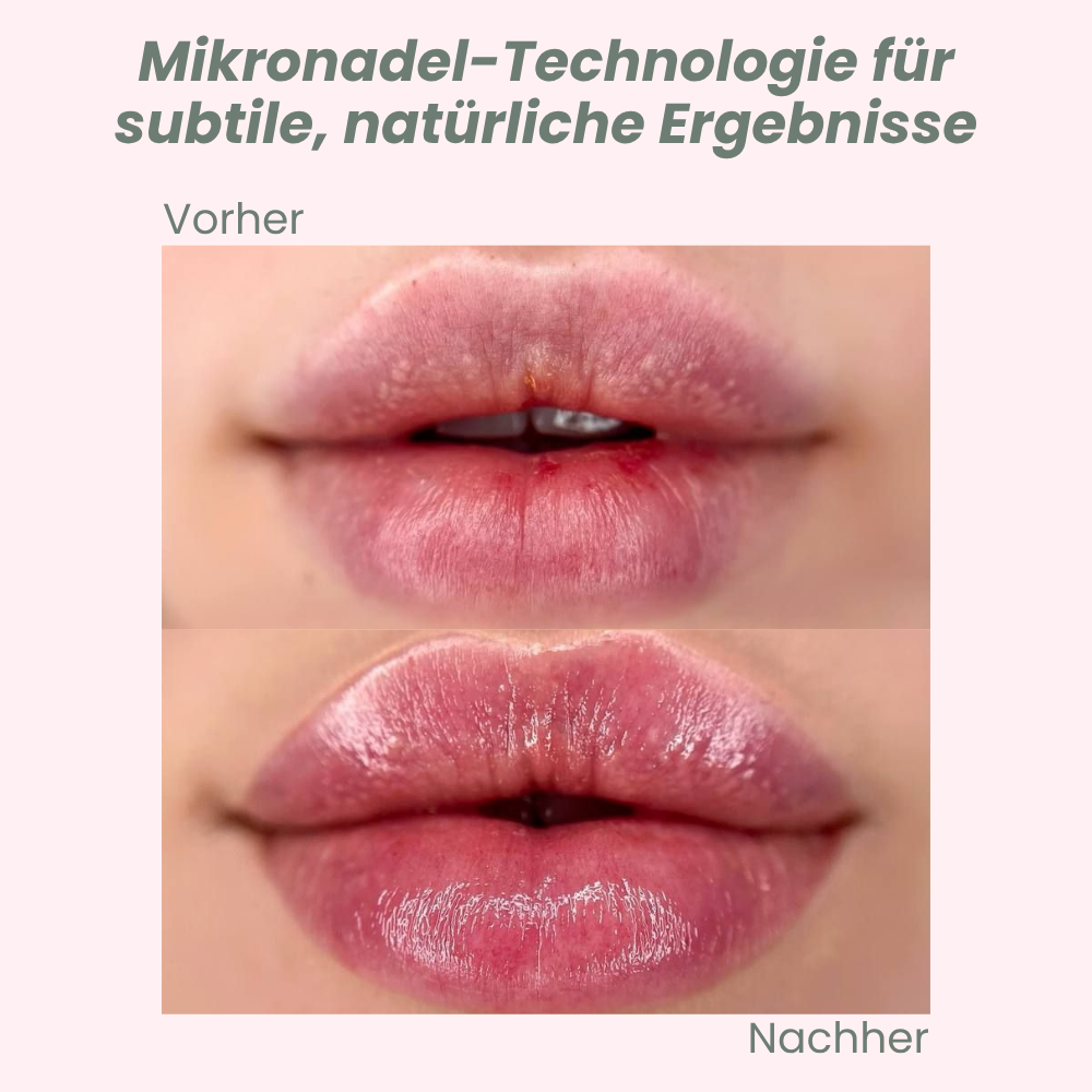 VoluPout™ — Verführerische, pralle Lippen ohne Nadeln in Minuten