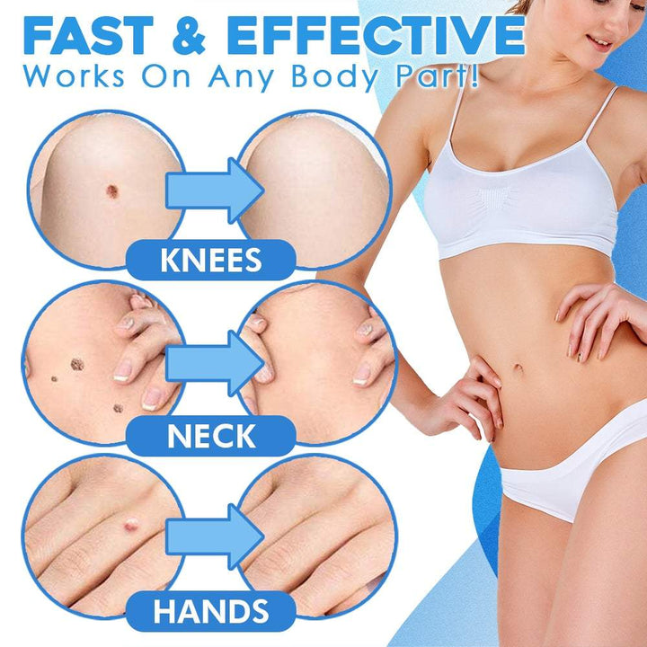 SkinShed Pro™ — Endlich glatte Haut ohne Schmerzen oder Narben in nur zwei Wochen!