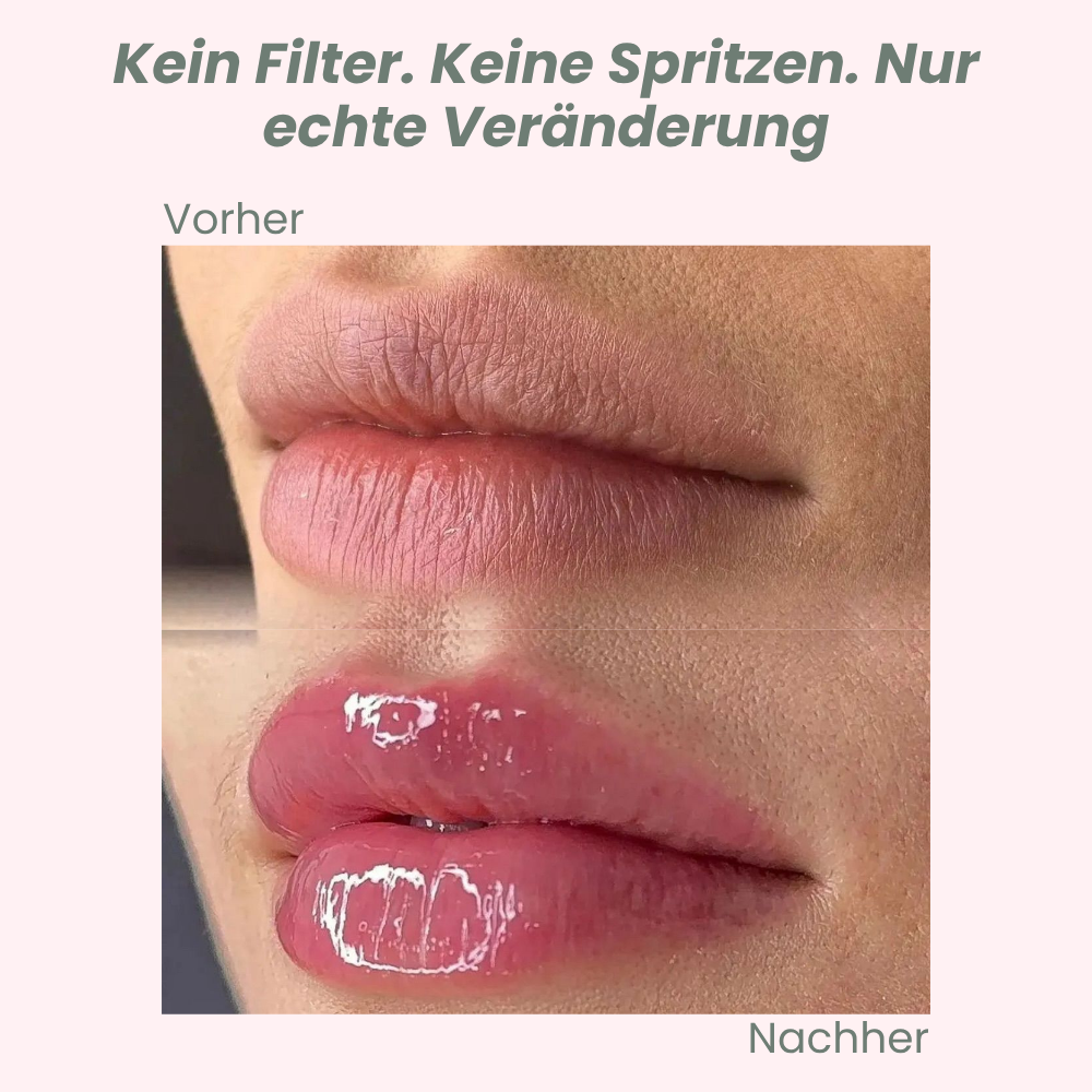 VoluPout™ — Verführerische, pralle Lippen ohne Nadeln in Minuten
