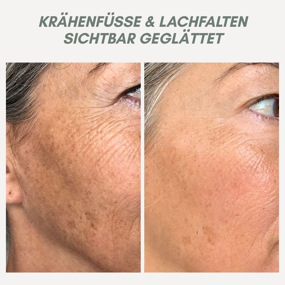 YouthMorph™ — Straffe Haut in Minuten für deinen jugendlichen WOW-Moment