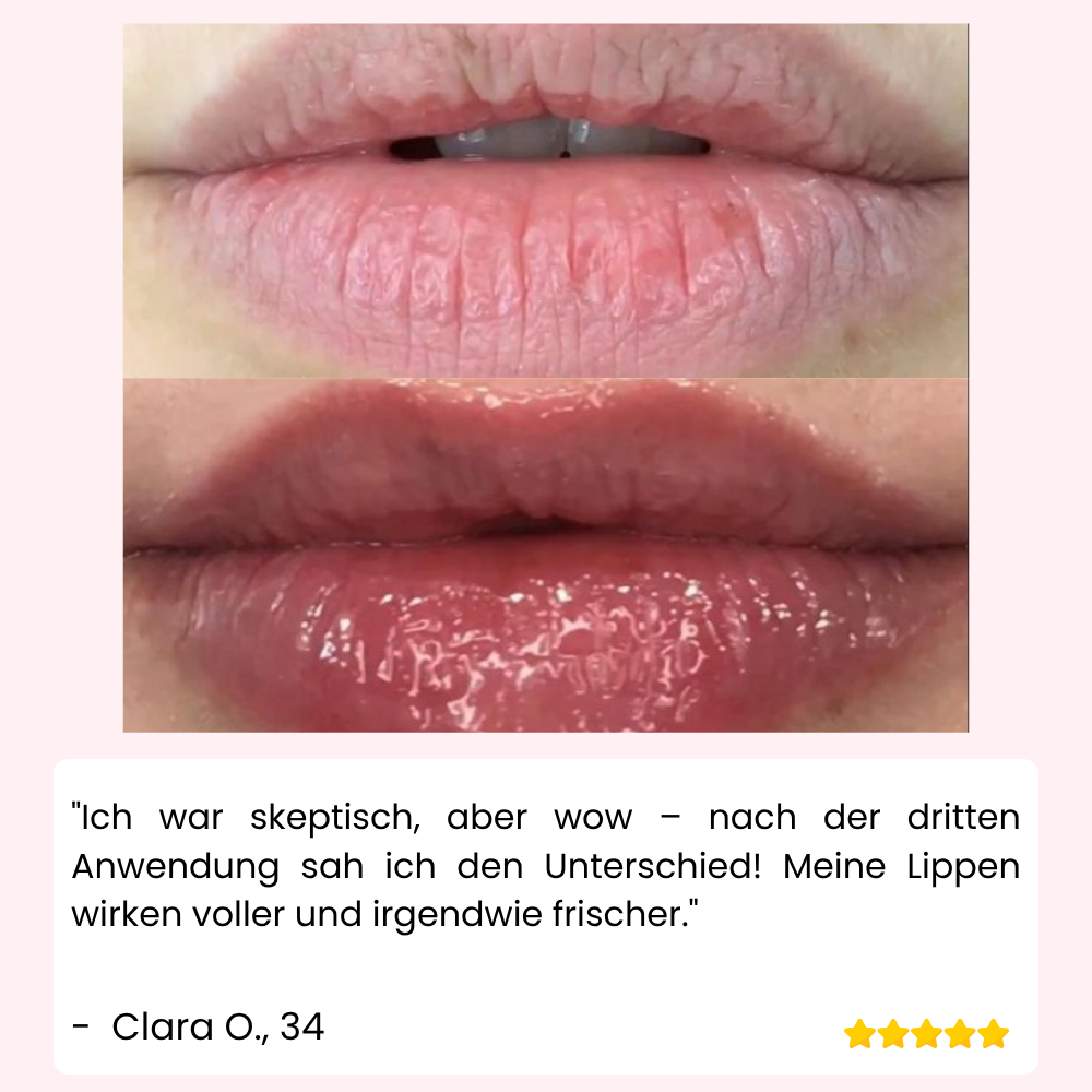VoluPout™ — Verführerische, pralle Lippen ohne Nadeln in Minuten