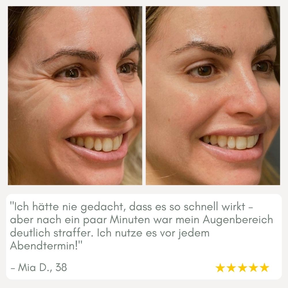 YouthMorph™ — Straffe Haut in Minuten für deinen jugendlichen WOW-Moment