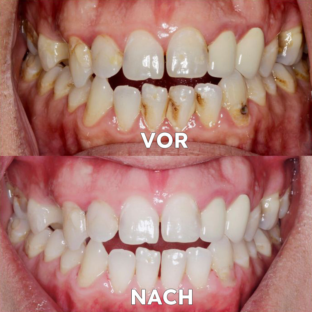 FrischeVibe™ — Spüre stundenlange Powerfrische ohne Chemie, die Bakterien wegfegt und dein Selbstbewusstsein beflügelt!