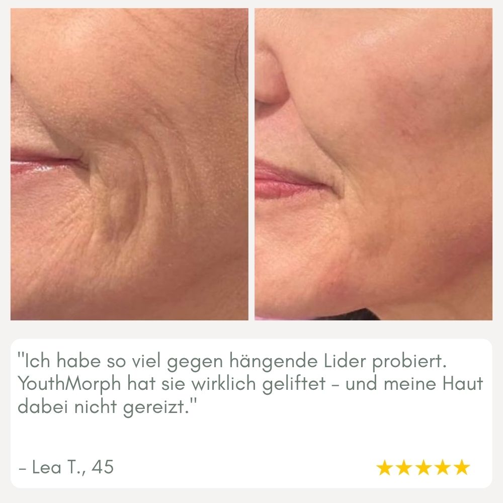 YouthMorph™ — Straffe Haut in Minuten für deinen jugendlichen WOW-Moment
