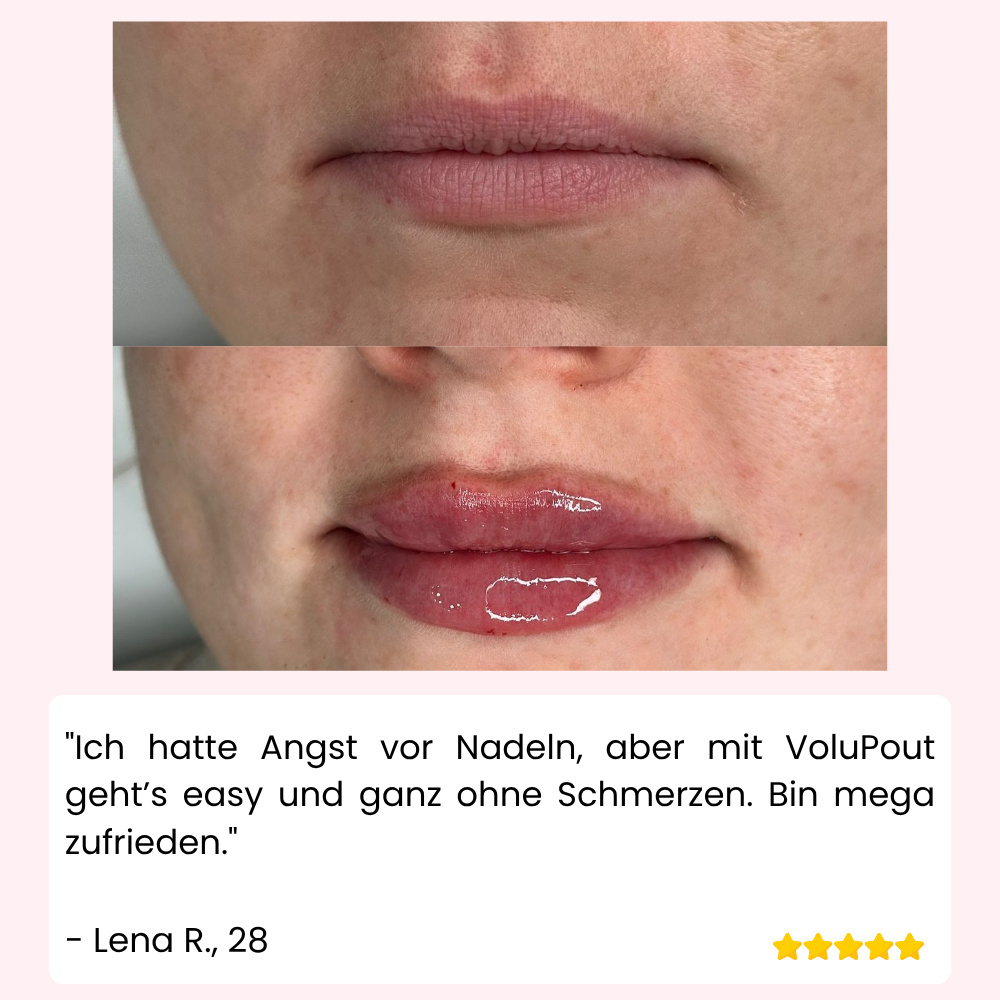 VoluPout™ — Verführerische, pralle Lippen ohne Nadeln in Minuten
