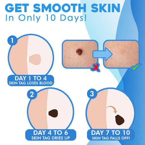 SkinShed Pro™ — Endlich glatte Haut ohne Schmerzen oder Narben in nur zwei Wochen!