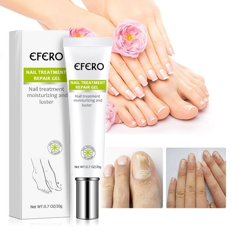 NailForce™ — Vernichte Pilze & entfessele die unbesiegbare Power deiner Nägel in nur 7 Tagen!