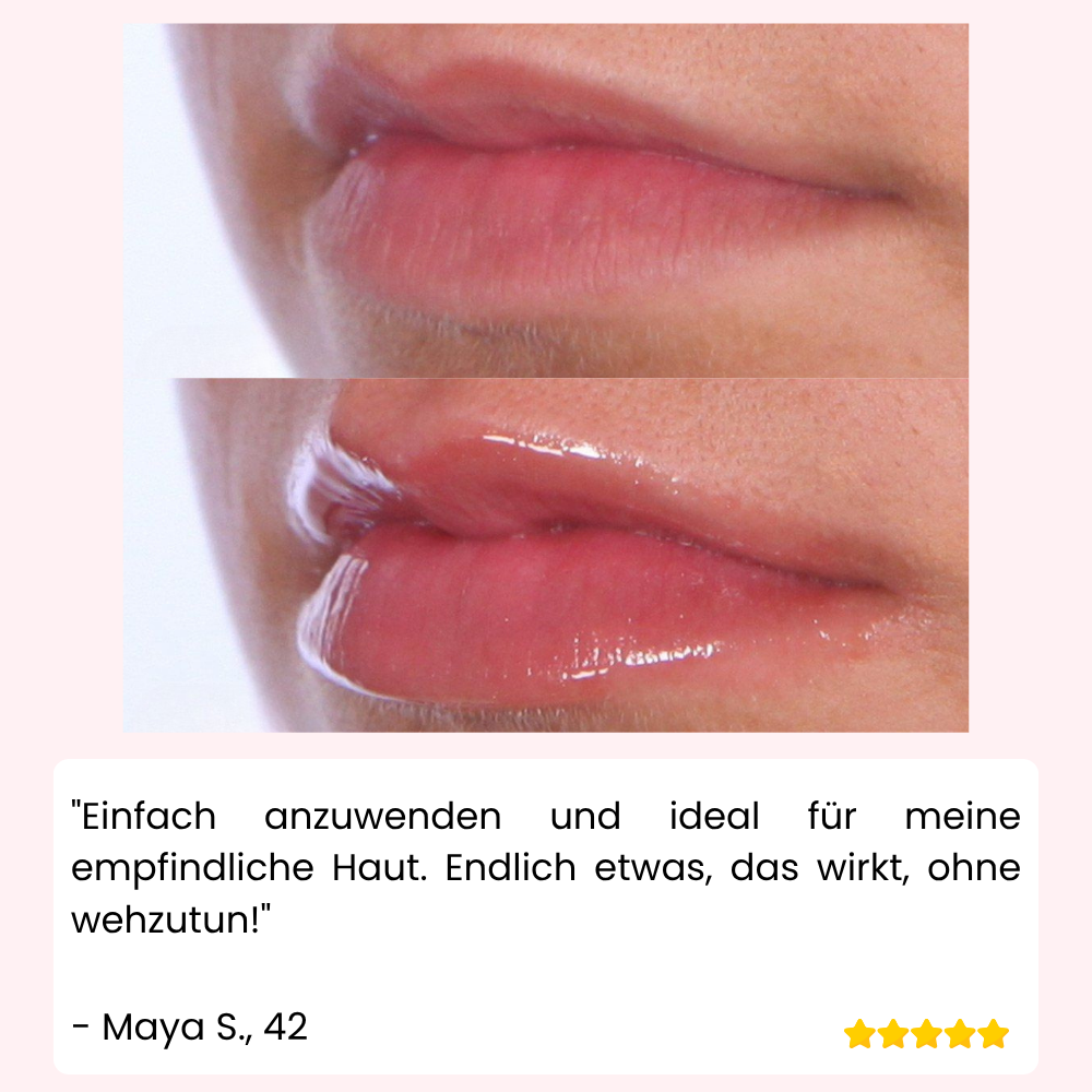 VoluPout™ — Verführerische, pralle Lippen ohne Nadeln in Minuten