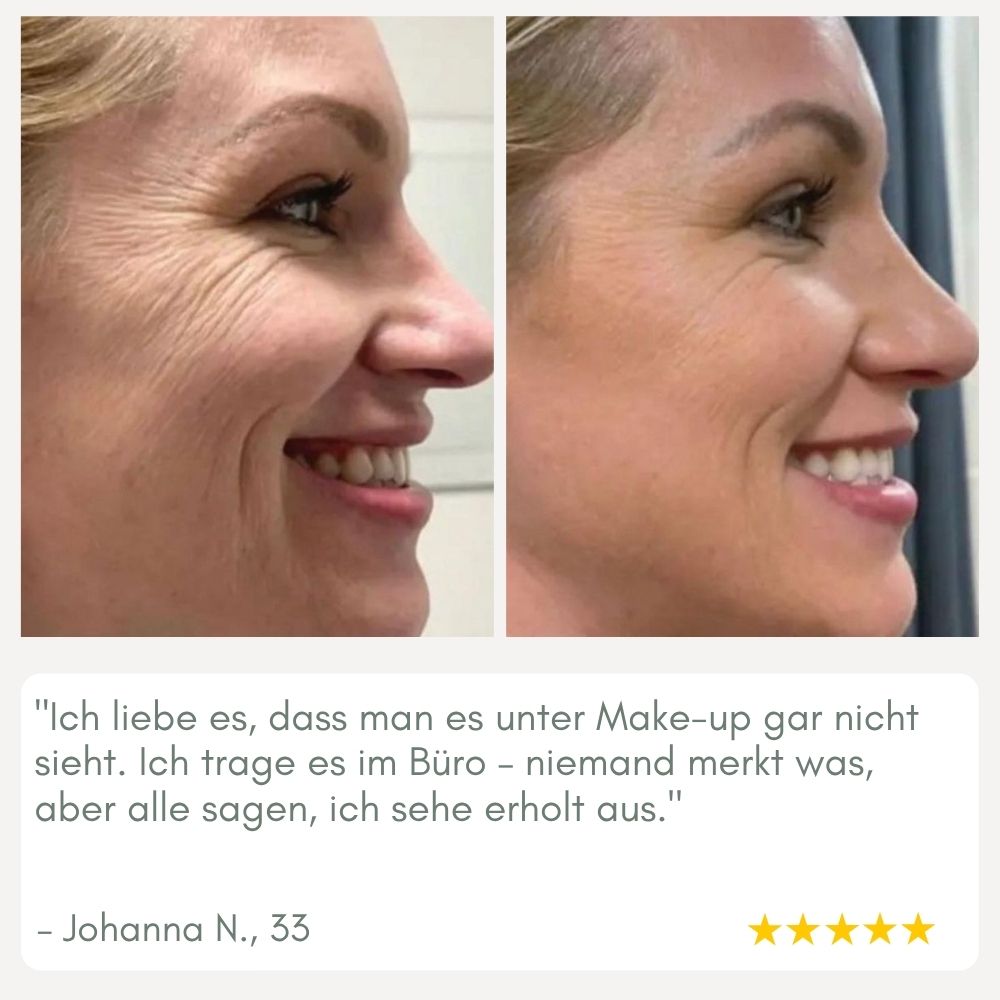 YouthMorph™ — Straffe Haut in Minuten für deinen jugendlichen WOW-Moment