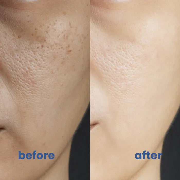 GlowVanta™ — Entfache dein strahlendes Selbstvertrauen mit makellos beruhigter Haut