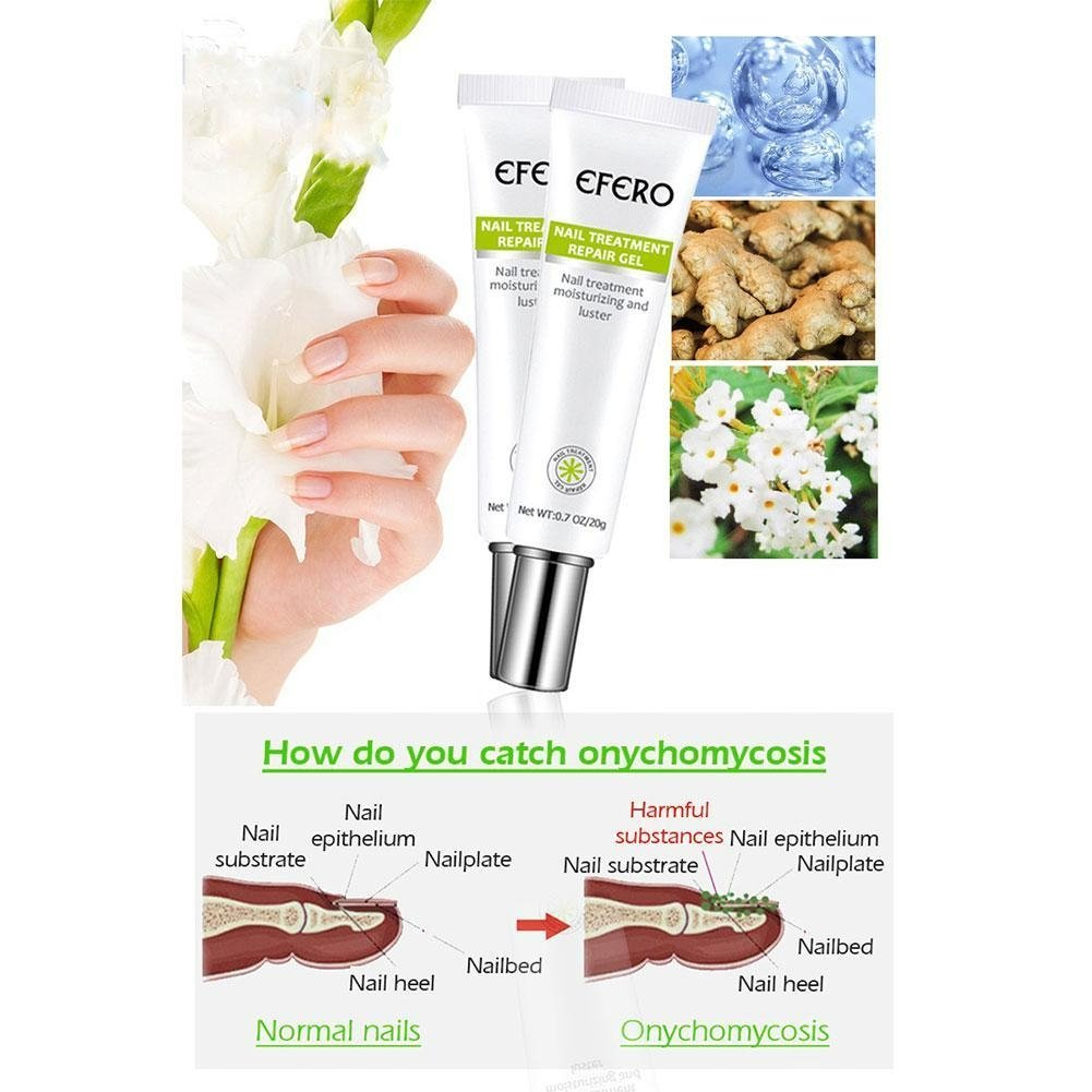 NailForce™ — Vernichte Pilze & entfessele die unbesiegbare Power deiner Nägel in nur 7 Tagen!