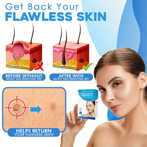 SkinShed Pro™ — Endlich glatte Haut ohne Schmerzen oder Narben in nur zwei Wochen!
