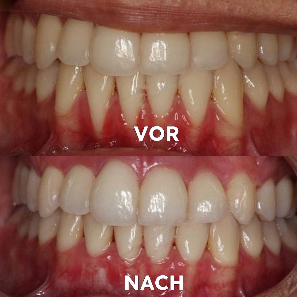 FrischeVibe™ — Spüre stundenlange Powerfrische ohne Chemie, die Bakterien wegfegt und dein Selbstbewusstsein beflügelt!