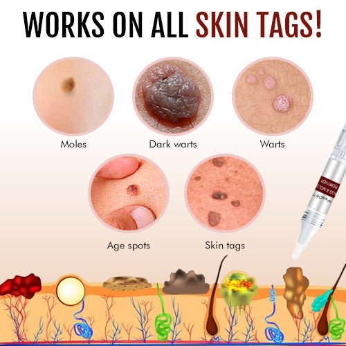 DermaBlitz™ — Endlich makellose Haut, die dein Selbstbewusstsein sofort stärkt