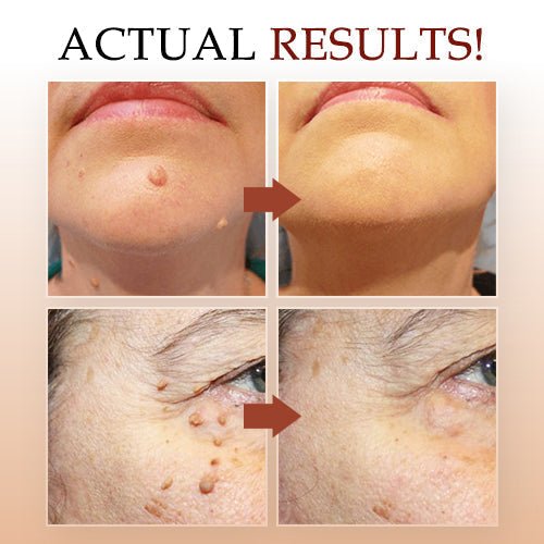 DermaBlitz™ — Endlich makellose Haut, die dein Selbstbewusstsein sofort stärkt