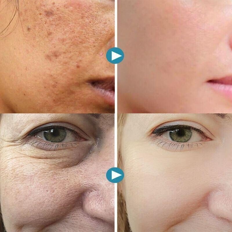 UltimaLift™ — Entfessle den strahlenden Glow, der dich jünger und unwiderstehlich macht!
