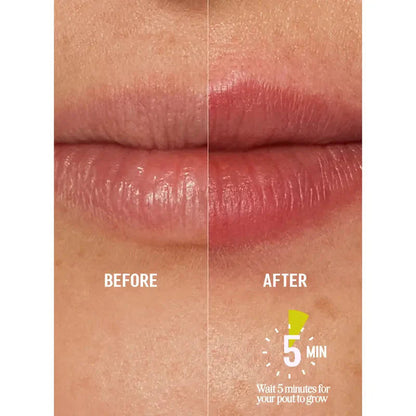 LipLuxx — Volle, Verführerische Lippen, Die Deinen Selbstbewusstsein Boostern