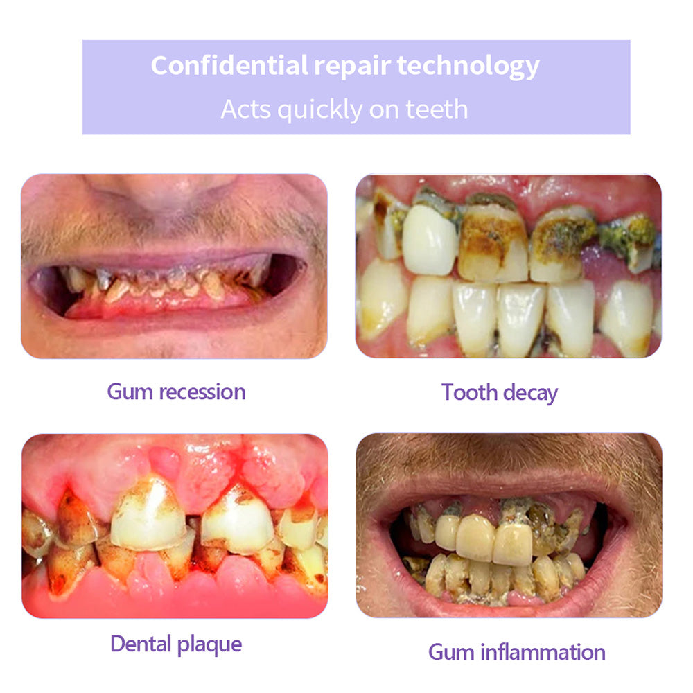 BrightGuard™ Dental Rescue Pulver — Hol dir dein schmerzfreies Lächeln zurück und stoppe Zahnprobleme an der Wurzel!