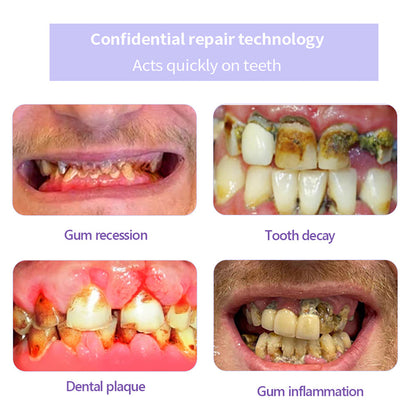 BrightGuard™ Dental Rescue Pulver — Hol dir dein schmerzfreies Lächeln zurück und stoppe Zahnprobleme an der Wurzel!