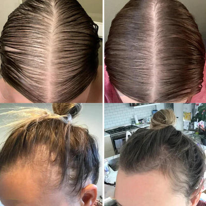 VitaFolliX — Entfache deine Haarwurzeln für eine kraftvolle, unwiderstehliche Mähne