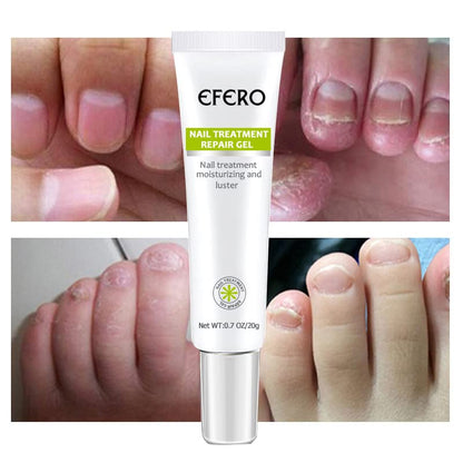NailForce™ — Vernichte Pilze & entfessele die unbesiegbare Power deiner Nägel in nur 7 Tagen!
