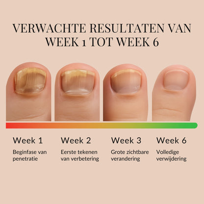 NailVibe Repair Patches — Endlich selbstbewusst nackte Füße zeigen ohne Scham!