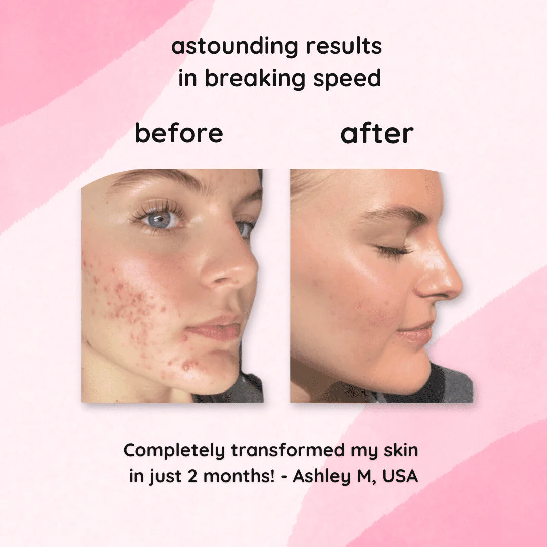 RadianceRush Gold Pads — Entfache deinen sofortigen jugendlichen Glow und strahle pure Schönheit aus! (40 Stück)