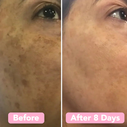 TurboGlow Pads — Entfache deinen strahlenden Teint und verabschiede dich für immer von dunklen Flecken!