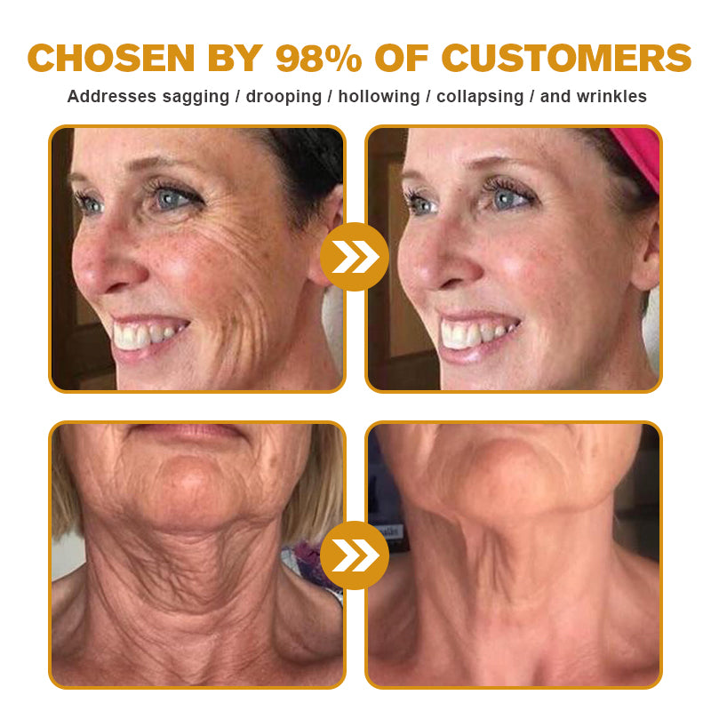 SkinCommand™ PowerLift Creme — Sofort straffere, prallere Haut, die dich jung und unwiderstehlich macht