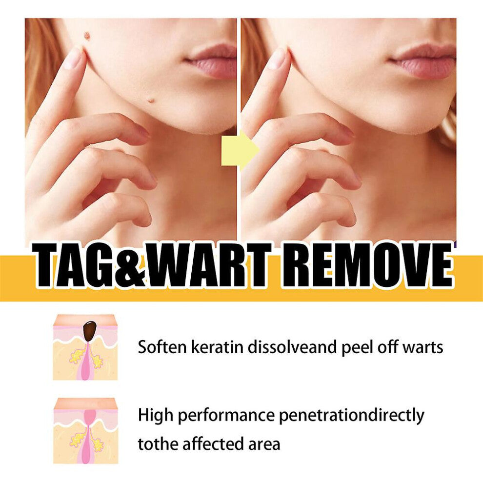 SkinReboot™ — Endlich schmerzfrei zu strahlend makelloser Haut, die jede Aufmerksamkeit verdient!