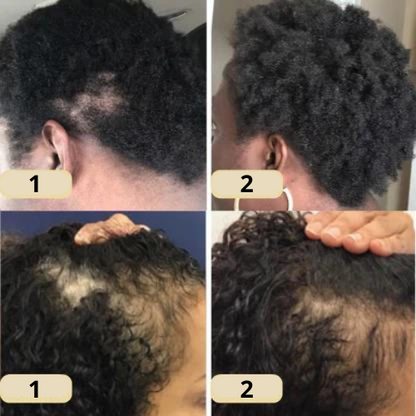VitaFolliX — Entfache deine Haarwurzeln für eine kraftvolle, unwiderstehliche Mähne