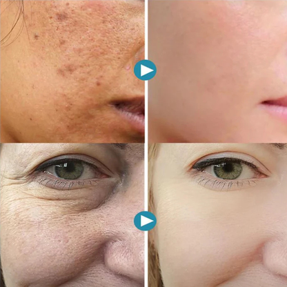 PureSkinX™ — Strahlend glatte Haut, die dein Selbstbewusstsein entfesselt