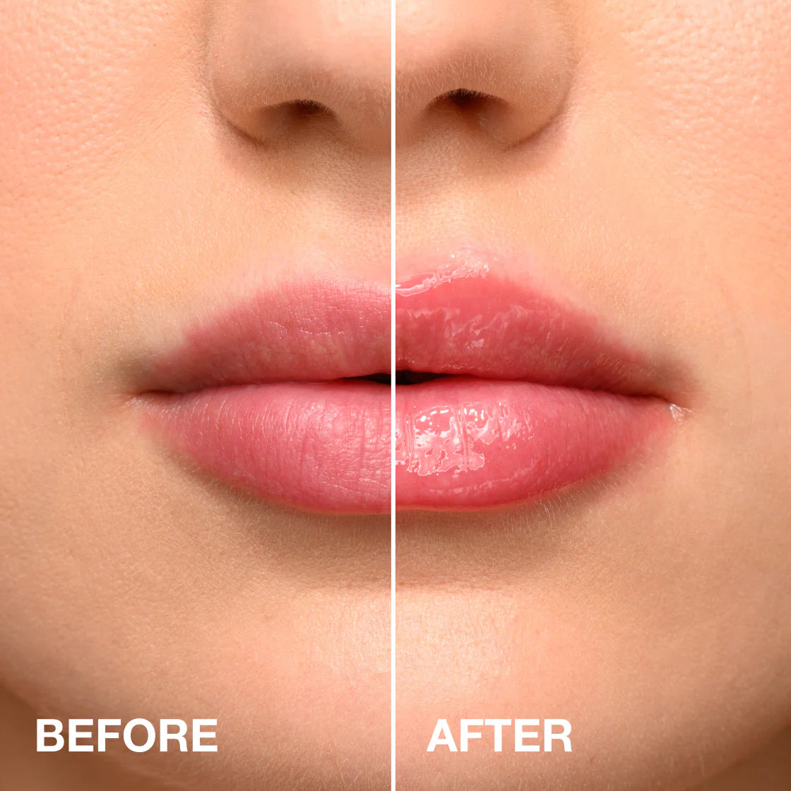LipLuxx — Volle, Verführerische Lippen, Die Deinen Selbstbewusstsein Boostern