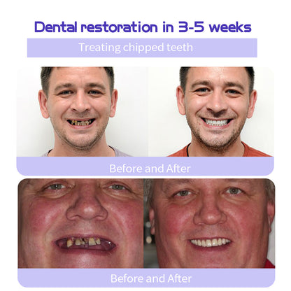 BrightGuard™ Dental Rescue Pulver — Hol dir dein schmerzfreies Lächeln zurück und stoppe Zahnprobleme an der Wurzel!