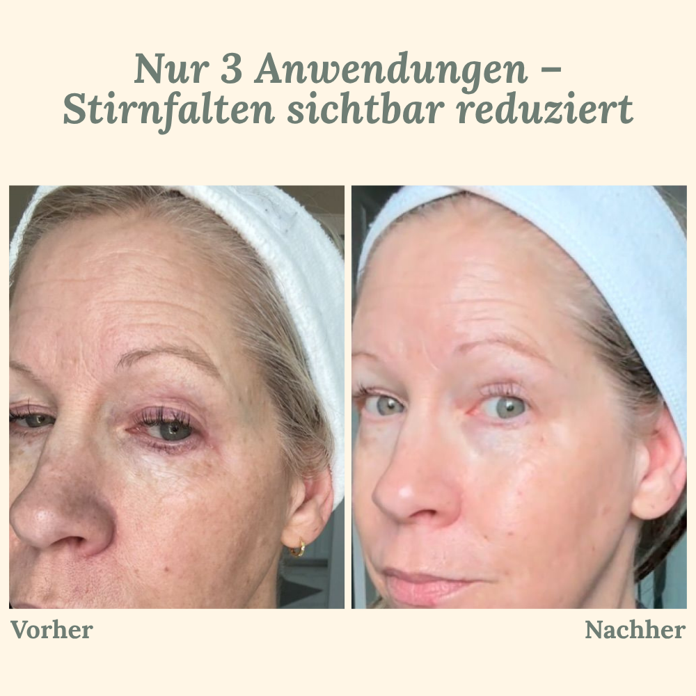VividVeil — Deine Haut strahlt jugendlich prall und faltenfrei wie nie zuvor! (5 Stück)