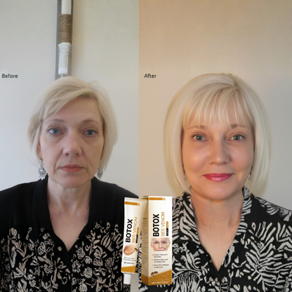 VitalBiene™ — Entfalte jugendliche Straffheit und strahlende Frische ohne Nadeln!