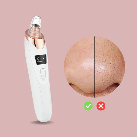 Nano Electrical Vacuum Blackhead Remover — Entfessle deine strahlend klare Haut ohne Schmerzen oder Stress