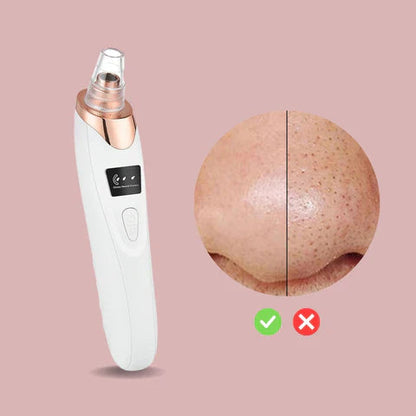 Nano Electrical Vacuum Blackhead Remover — Entfessle deine strahlend klare Haut ohne Schmerzen oder Stress