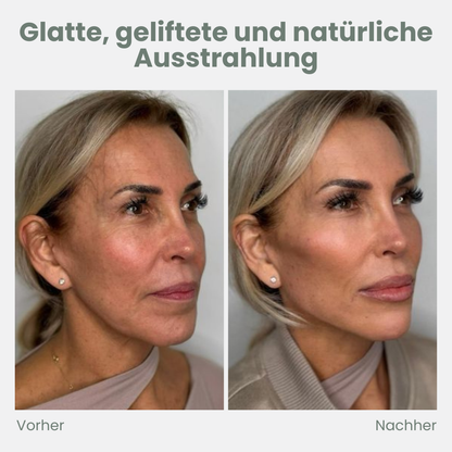 LuxLift™ — Heb dein Kinn, strahle Jugendlichkeit aus ohne OP!