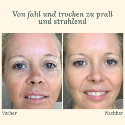 VividVeil — Deine Haut strahlt jugendlich prall und faltenfrei wie nie zuvor! (5 Stück)