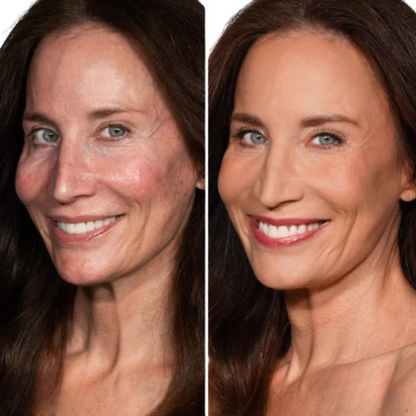 SkinFire Boost™ — Verjünge Deine Haut sofort mit strahlender Frische und makelloser Leichtigkeit