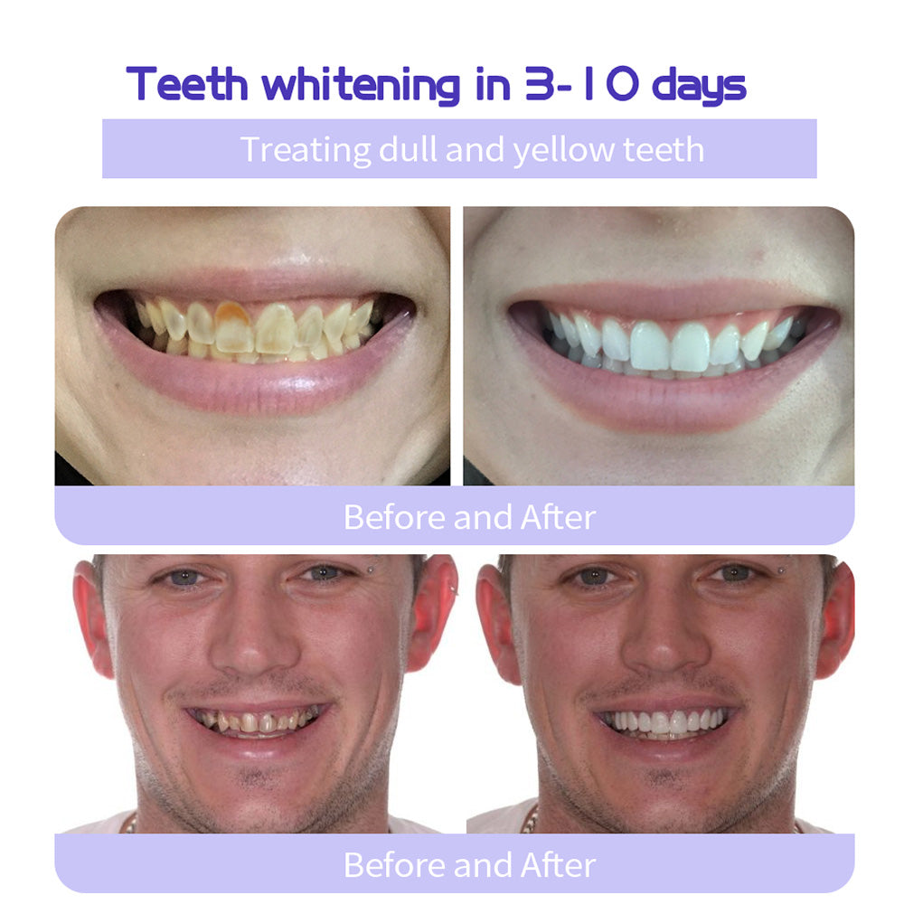 BrightGuard™ Dental Rescue Pulver — Hol dir dein schmerzfreies Lächeln zurück und stoppe Zahnprobleme an der Wurzel!