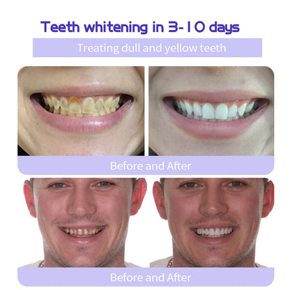 BrightGuard™ Dental Rescue Pulver — Hol dir dein schmerzfreies Lächeln zurück und stoppe Zahnprobleme an der Wurzel!