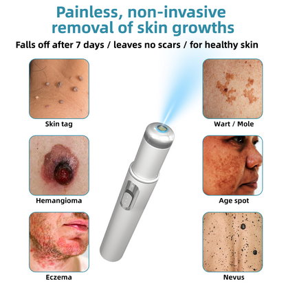 ClearSkinPro™ — Schmerzfrei zu makelloser Haut, die jeden Spiegel zum Freund macht