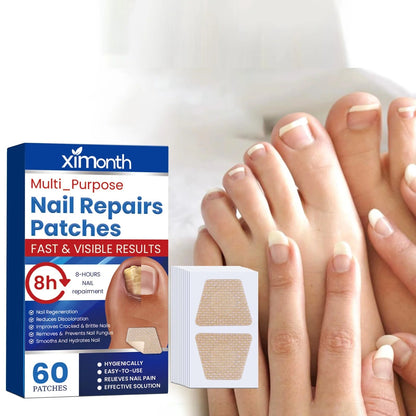 NailRescue Power-Patches — Endlich selbstbewusst mit makellos gesunden Nägeln, die keiner mehr verstecken will!